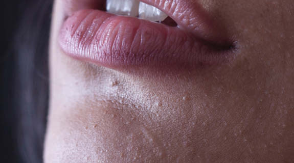 blog-575x320-fuehl-unrein-haut-88077-0