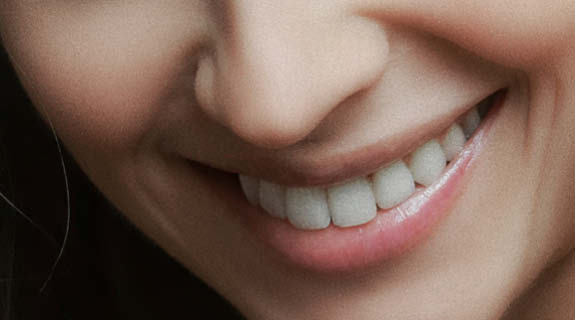 blog-575x320-fasz-sproede-lippen-1-88051-0