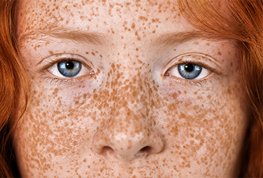 20231002-banner-sommer-sonne-aktion-376x255-02-80680-0